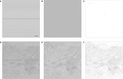 Content-Aware Segmentation of Objects Spanning a Large Size Range: Application to Plankton Images